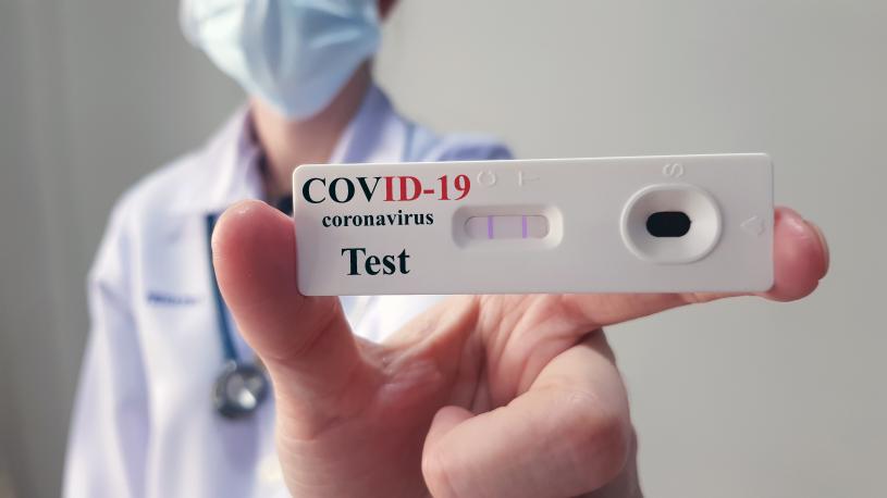 Anvisa aprova testes rápidos para covid-19 em farmácias